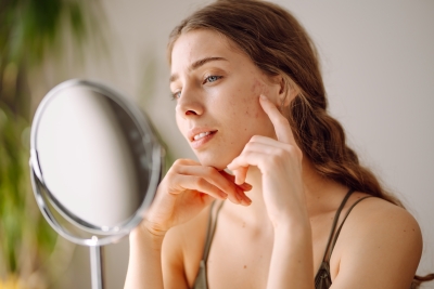 Amorepacific microbiome extract targets post-acne pigmentation